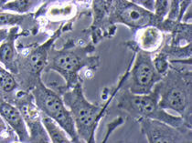 Konfluente HeLa-Zellen mit Hefe-Kontamination